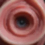 Pathological representation of vulvar neoplasia
