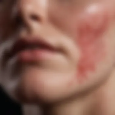 Close-up of inflamed skin exhibiting eczema symptoms