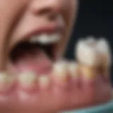 Detailed view of resin infiltration technique in dental practice