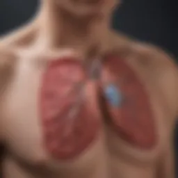 Illustration depicting the pathophysiology of ARDS pneumonia