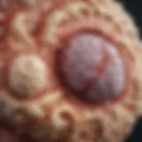 Illustration of ganglioglioma tumor structure