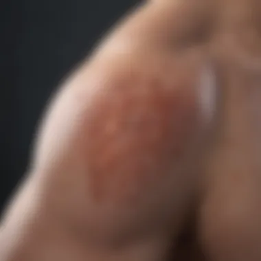 Environmental Influences on Plaque Psoriasis Environmental factors influencing plaque psoriasis