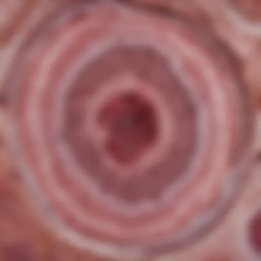 Histological slide of medulloblastoma highlighting cellular characteristics