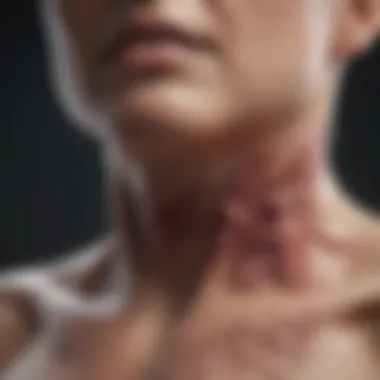 Impact of Lymph Node Involvement Lymph node metastasis in thyroid cancer
