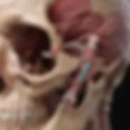 Illustration of trigeminal schwannoma location within the cranial structure