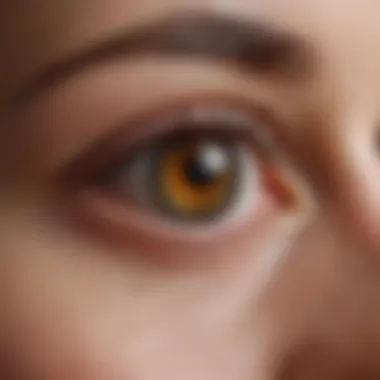 Technique of Administering Eye Injections for Retinal Conditions Diagram showing the technique of administering eye injections