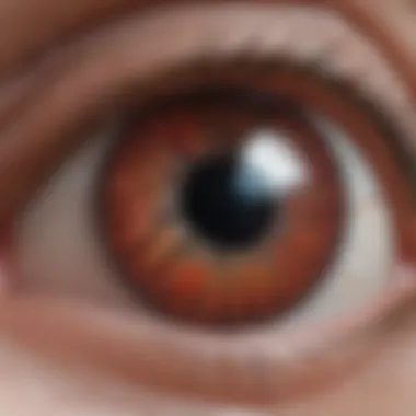 Illustration of retinal anatomy highlighting bleeding areas